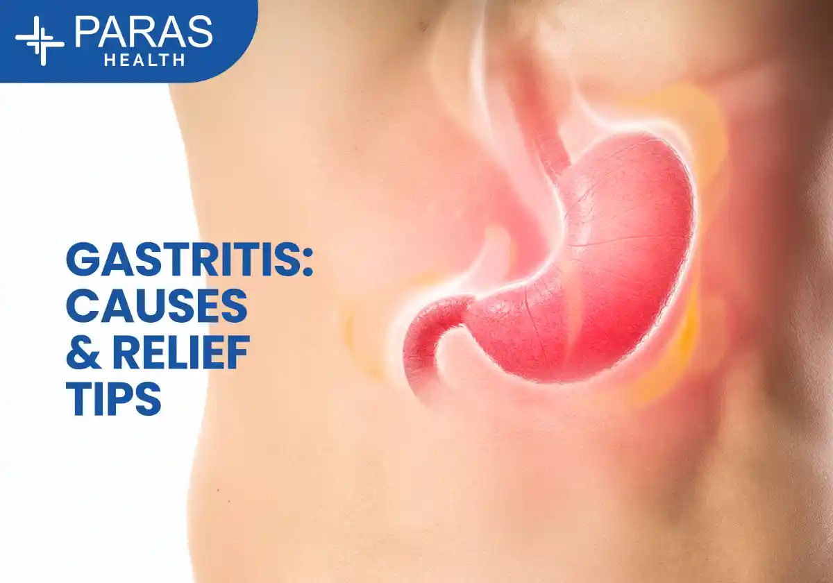 Gastritis: Symptoms, Causes, Treatment & Best Diet for Fast Relief